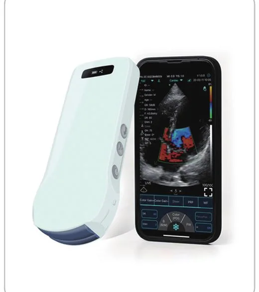 YSB-C10T — Ecógrafo inalámbrico