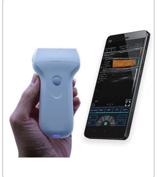 YSB-C10UL — Ecógrafo inalámbrico