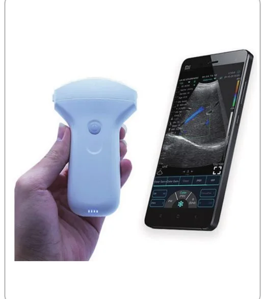 YSB-C10UR — Ecógrafo inalámbrico