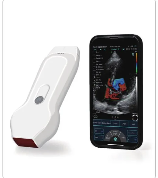 YSB-C10XL — Ecógrafo inalámbrico